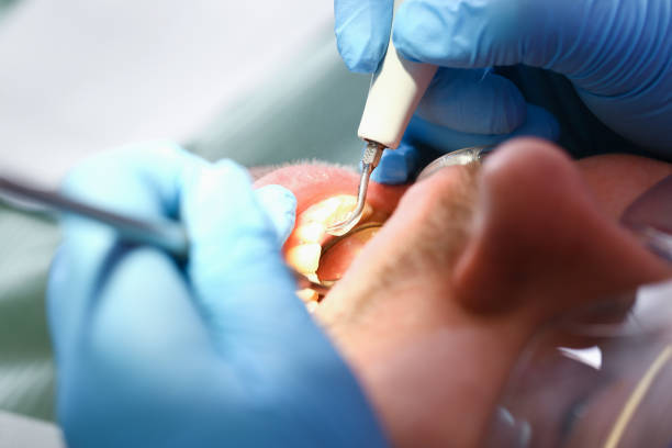 Best Emergency Cosmetic Dentistry in Depew, NY