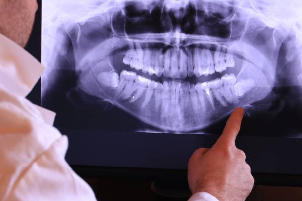 Best Mobile Emergency Dentist in Depew, NY