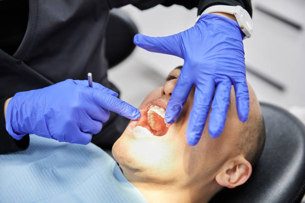 Best Mobile Emergency Dentist in Depew, NY